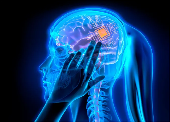 neurocirugía