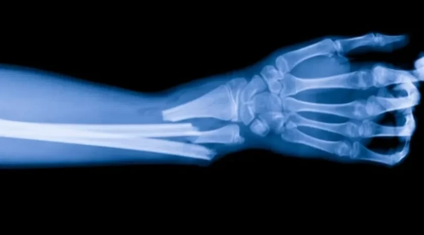 bone-02