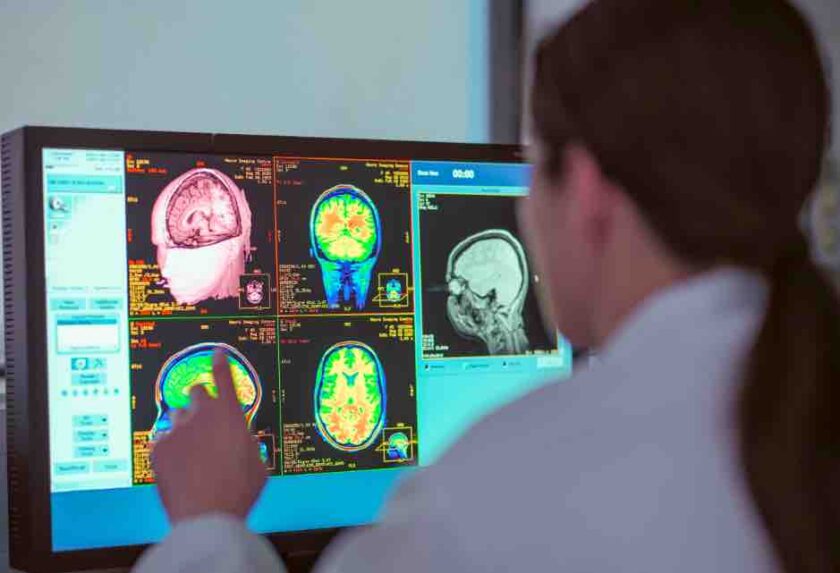 cerebro crio preservado