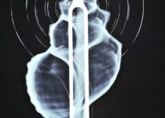 Muestra artística devela las fascinantes alegorías de los rayos X  